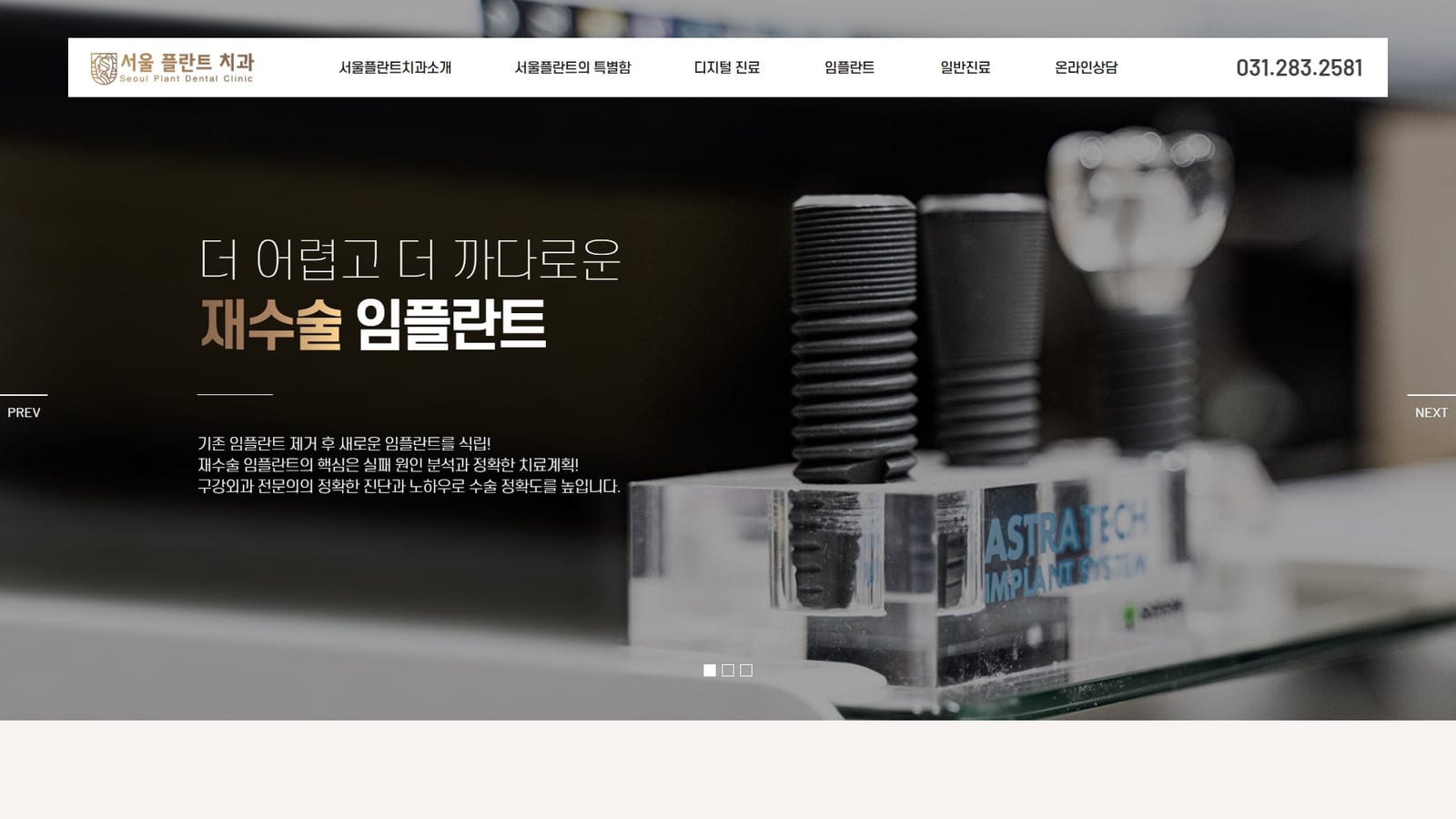 서울플란트치과 ㅣ 임플란트59